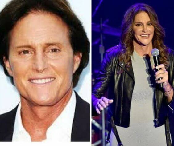 Before and after picture of William Hugh Jenner child Caitlyn Jenner.